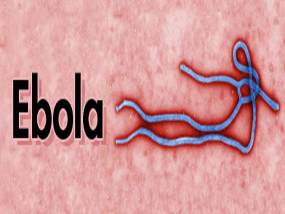 فيروس الإيبولا